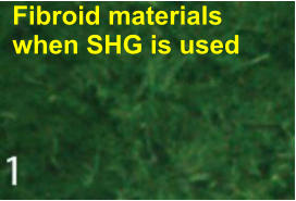 Fibroid materials when SHG is used